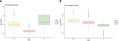 Investigating phenotypic plasticity due to toxicants with exposure disparities in primary human breast cells in vitro